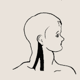 Расположение кивательной мышцы на шее